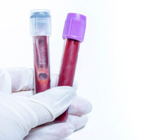 Blood test can detect some early cancers